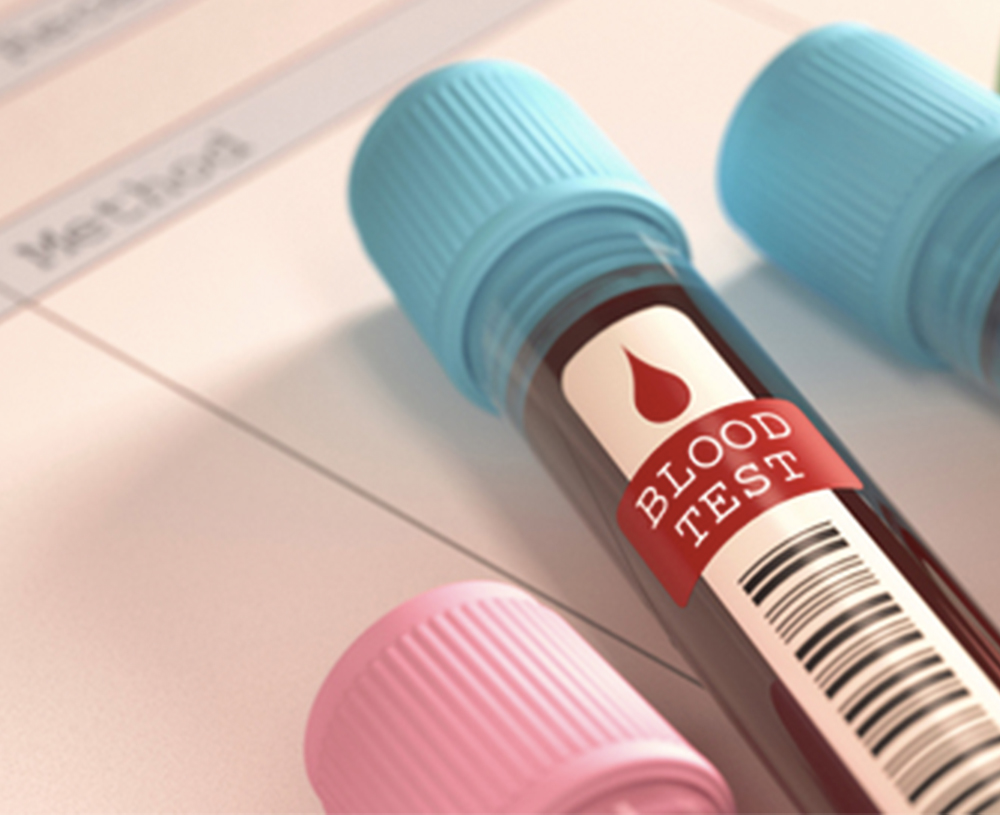 Wellness Blood Tests: What They Check For and Why They Matter