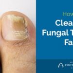 Effective Home Remedies That Kill Toenail Fungus Fast